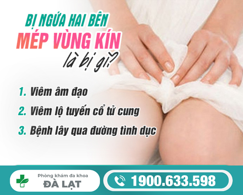 Hình ảnh minh họa